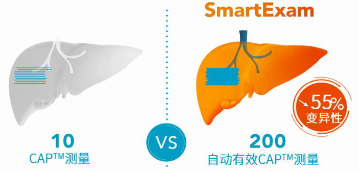 看见新力量|国产FibroScan® Pro无创肝病检测仪成医疗健康新热门