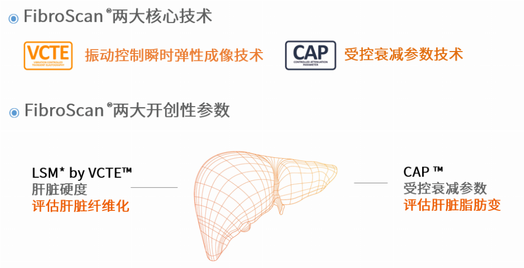 全国多家三甲医院引进全球领先FibroScan® 无创检测设备，脂肪肝精准检测仅需1min