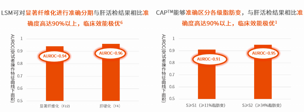 全国多家三甲医院引进全球领先FibroScan® 无创检测设备，脂肪肝精准检测仅需1min