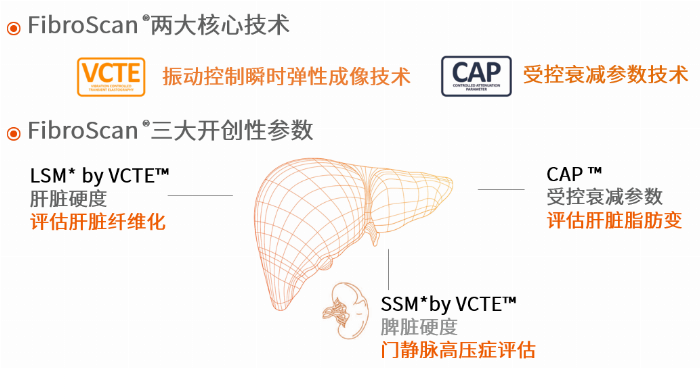 深圳回波医疗发布国产化FibroScan® 无创肝脏诊断系列产品